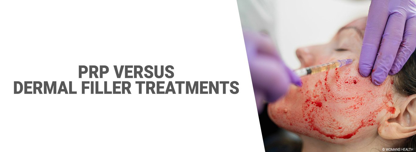PRP versus dermal filler treatments