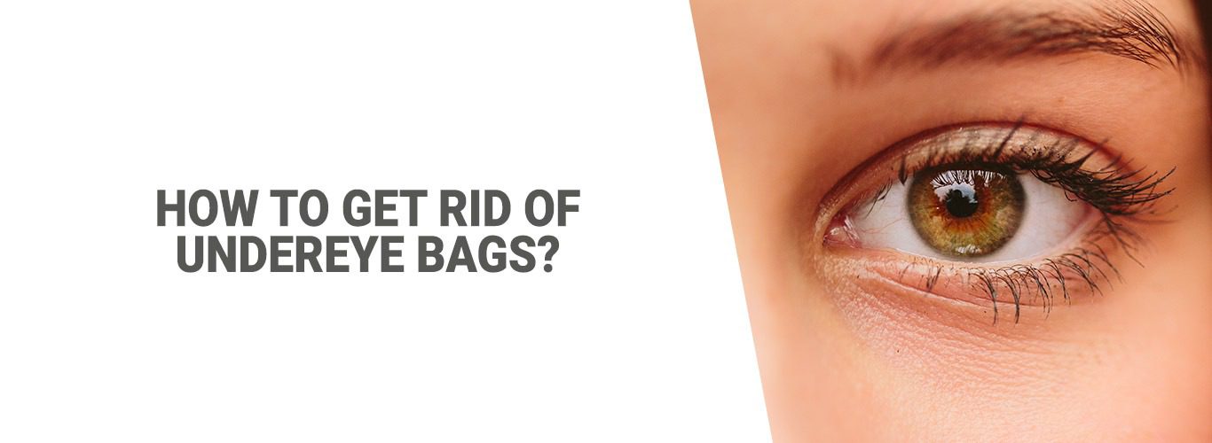 Blogpost:How to get rid of undereye bags?