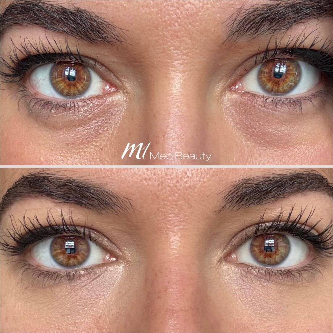 Anti-Wrinkle M1 Beauty (2)